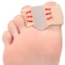 KALOA2PCToe Separator Hallux Valgus Bunion Corrector Orthotics Feet Bone Thumb Adjuster Correction Pedicure Feet Straightener