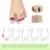 KALOA2PCToe Separator Hallux Valgus Bunion Corrector Orthotics Feet Bone Thumb Adjuster Correction Pedicure Feet Straightener